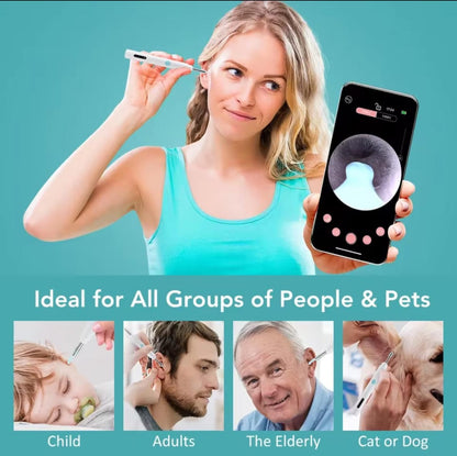 Ear Cleaner High Precision Ear Wax Removal Tool with Camera with LED Light Wireless Cleaner Smart Ear Cleaning Kit