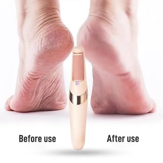 Pedicure Kits for Dry, Dead, Cracked, Hard Skin, Men, Women, Dead Cracked Hard Skin Calluses, Finishing Touch Flawless Pedi Electronic Tool File and Callus