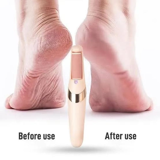 Pedicure Kits for Dry, Dead, Cracked, Hard Skin, Men, Women, Dead Cracked Hard Skin Calluses, Finishing Touch Flawless Pedi Electronic Tool File and Callus
